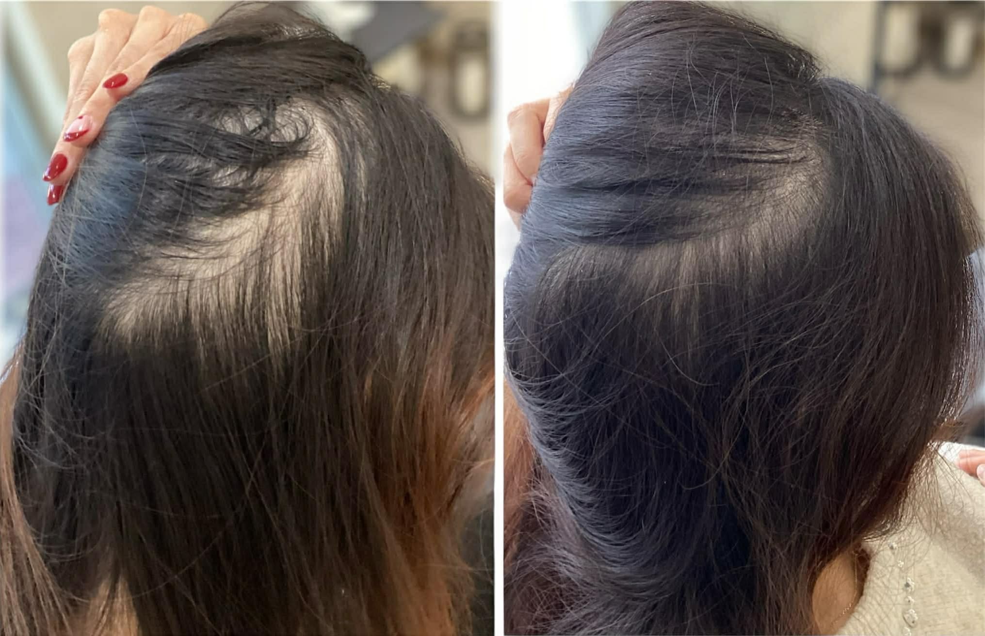 Before after result