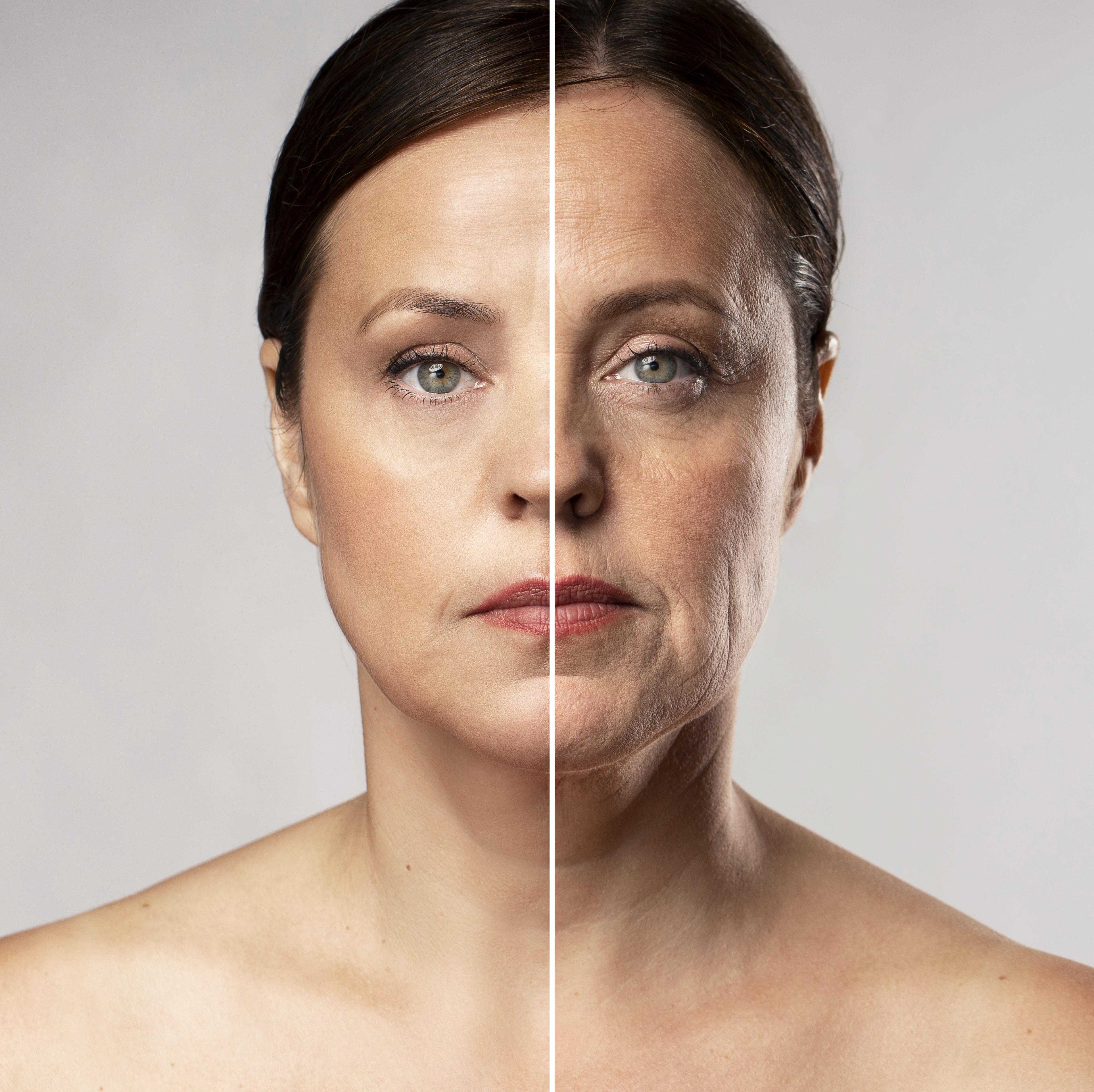 Anti-aging treatment