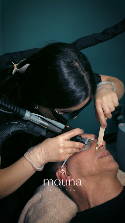 Traitement des Varices au Laser Elite iQ