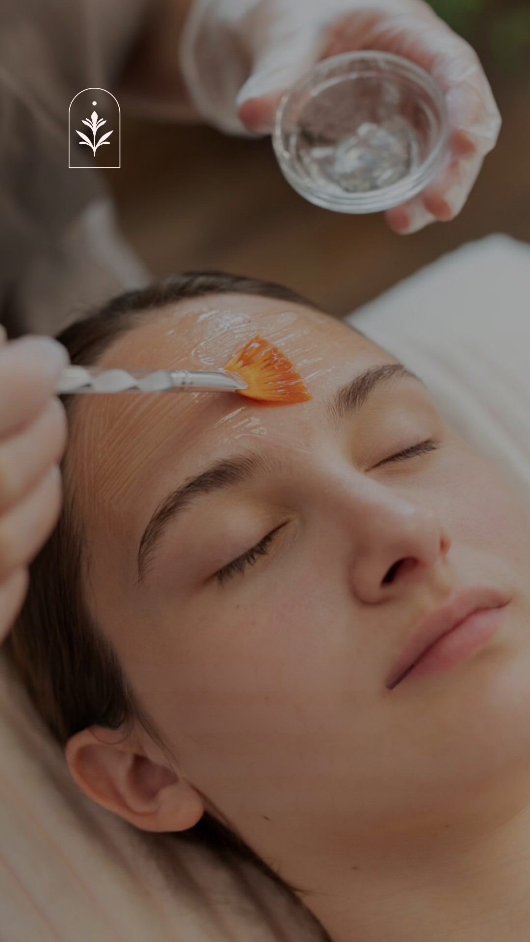 Chemical Peels