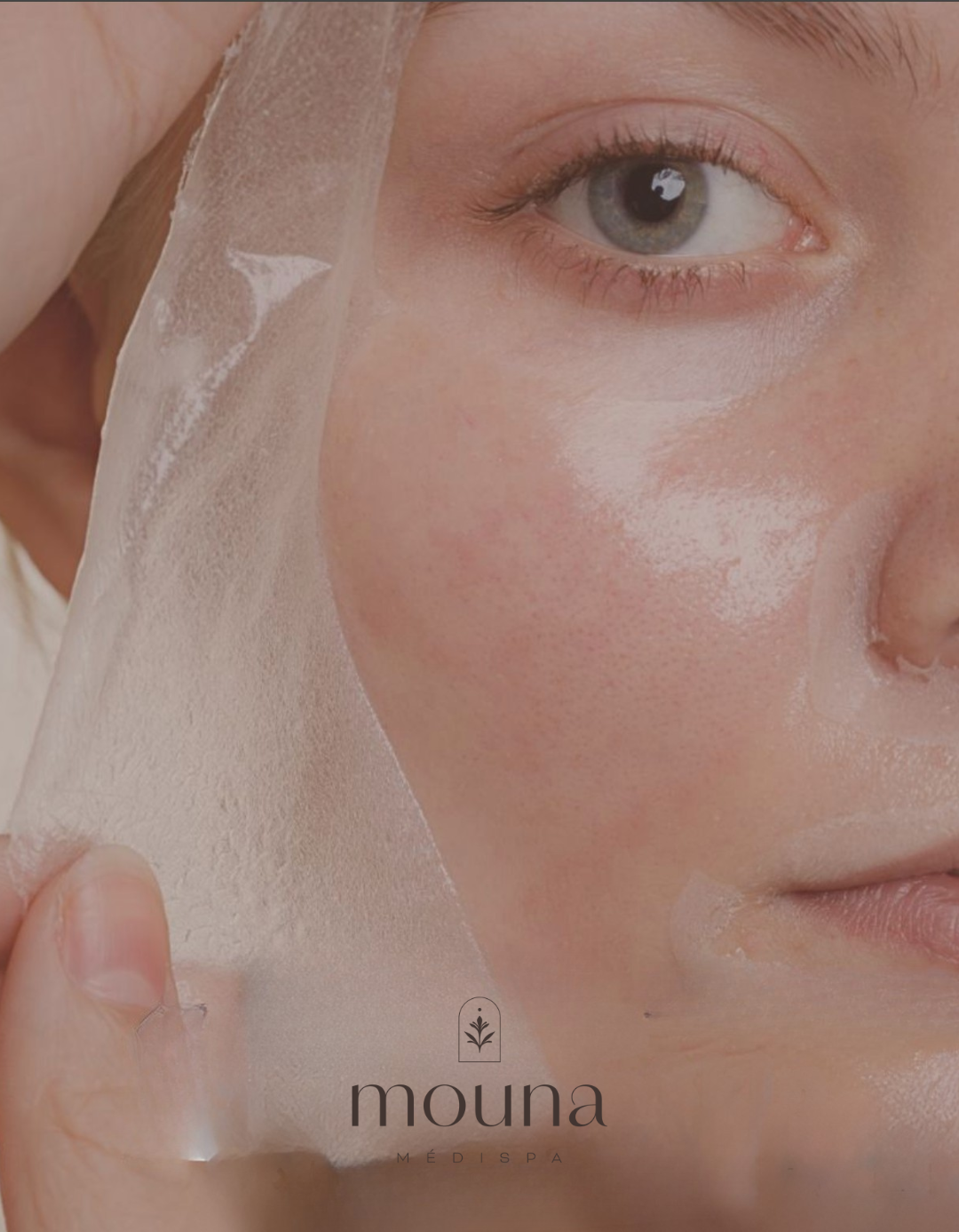 Peeling chimique personnalisé - Mouna Medispa